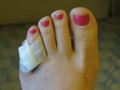 My sore toe