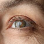 Glaucoma research biological age.